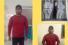 OTHER SURGERY 