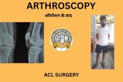 SPINE SURGERY - 1