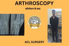 SPINE SURGERY - 1