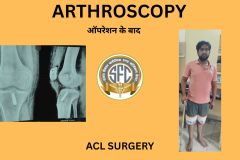 SPINE SURGERY - 1