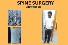 SPINE SURGERY