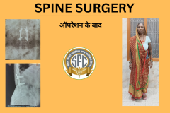 SPINE SURGERY - 1