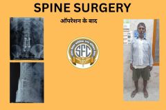 SPINE SURGERY - 1