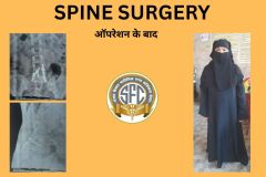 SPINE SURGERY - 1